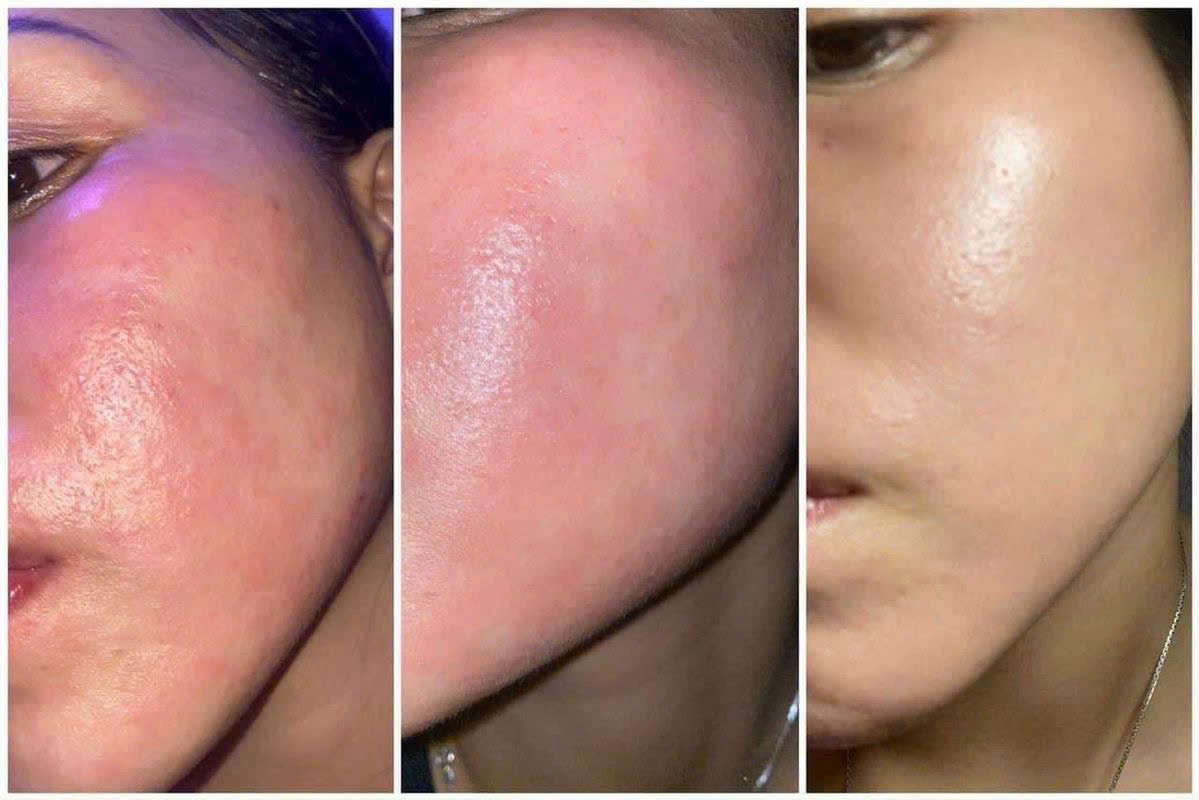 VÌ SAO MUỐN DA ĐẸP PHẢI PHỤC HỒI HÀNG RÀO DA TRƯỚC?